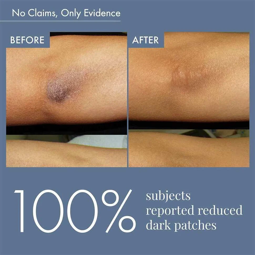 Dark Patches Corrector, 100ml - Image 5