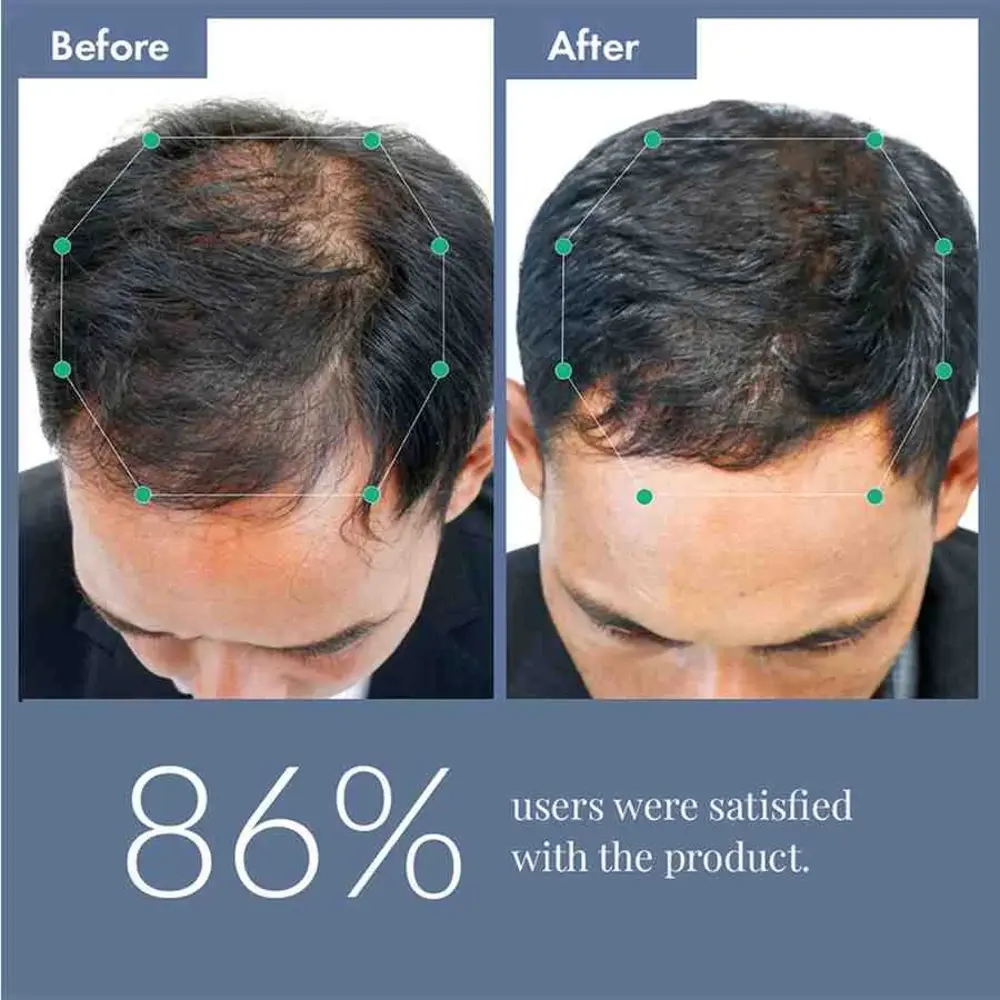 Hair Growth Serum 2.0 For Men & Women - Image 11