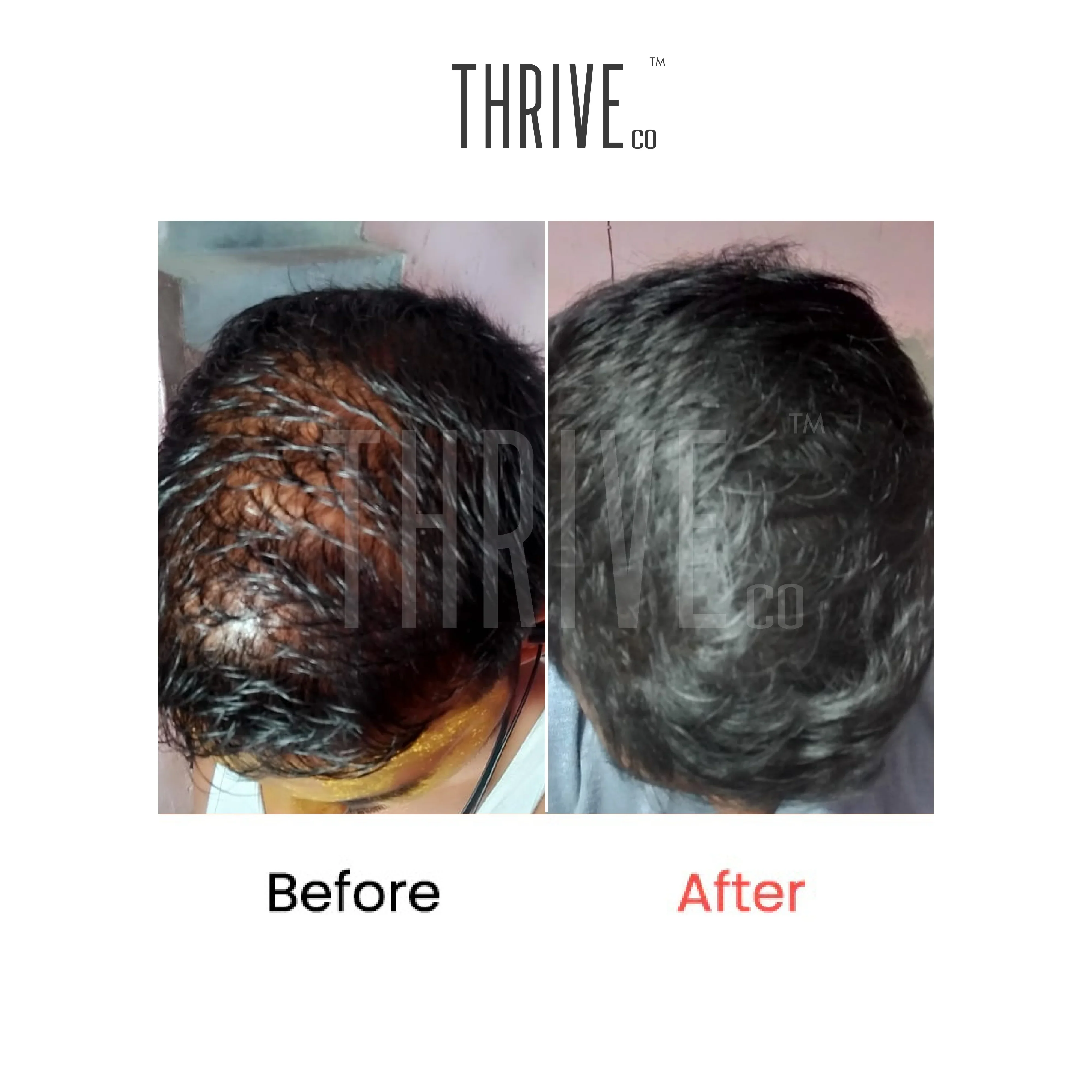 Hair Growth Serum (50ml) + Scalp Exfoliating Scrub (100ml) - Image 4