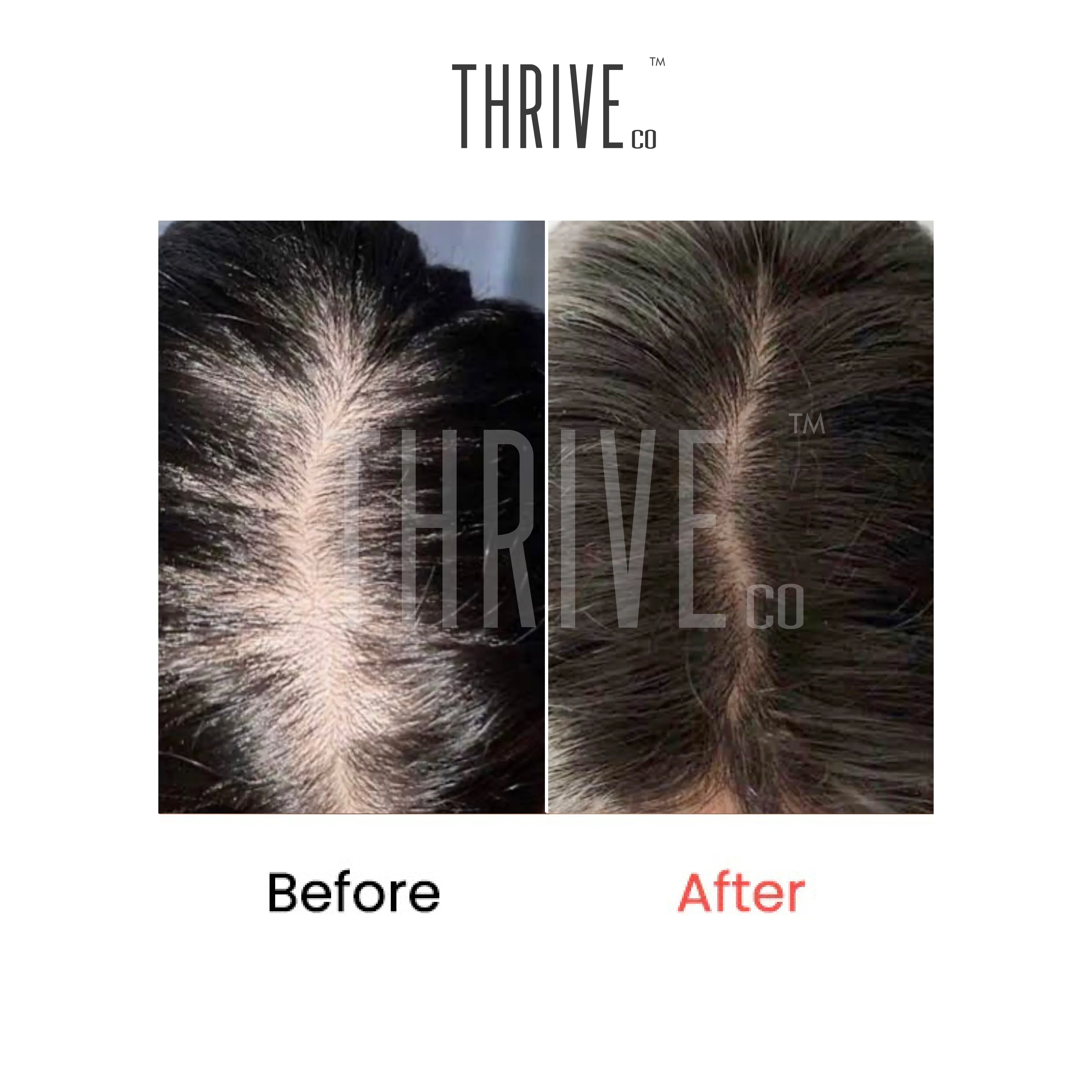Hair Growth Serum (50ml) + Scalp Exfoliating Scrub (100ml) - Image 5