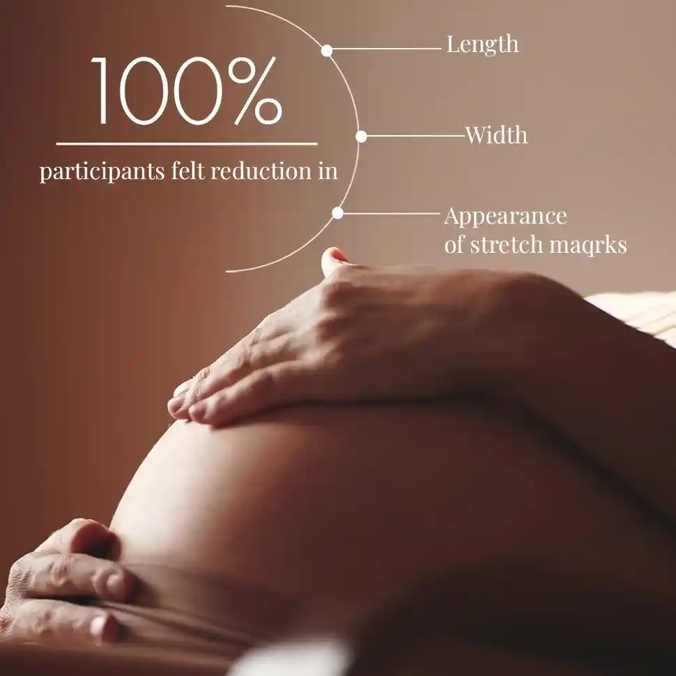 Stretch Marks Expert, Serum Cream 30ml - Image 10