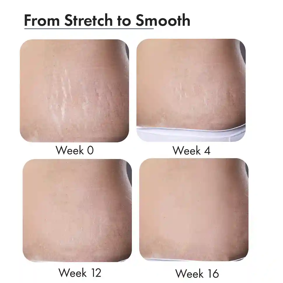 Stretch Marks Expert, Serum Cream 30ml - Image 12